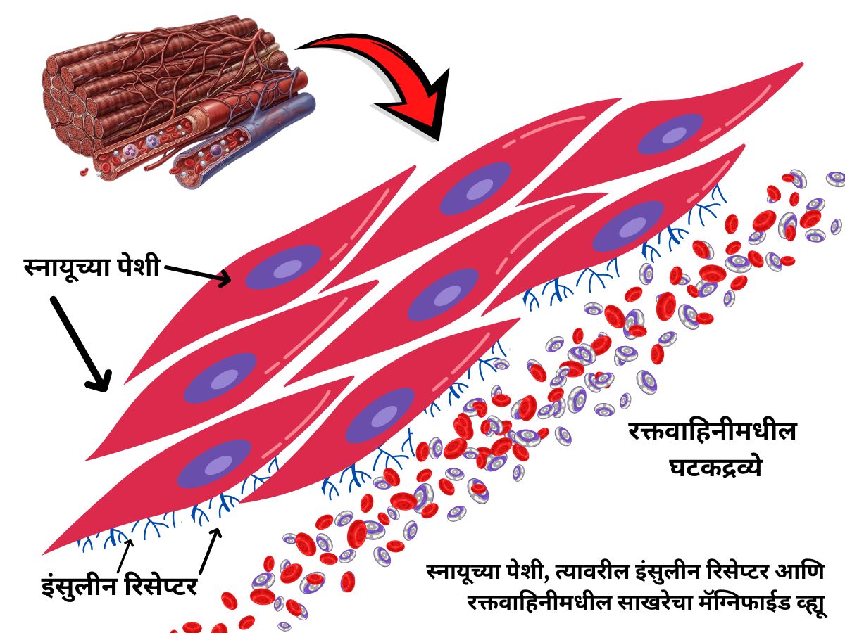 insulene resistance